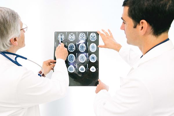 Doctors looking at scans of a brain